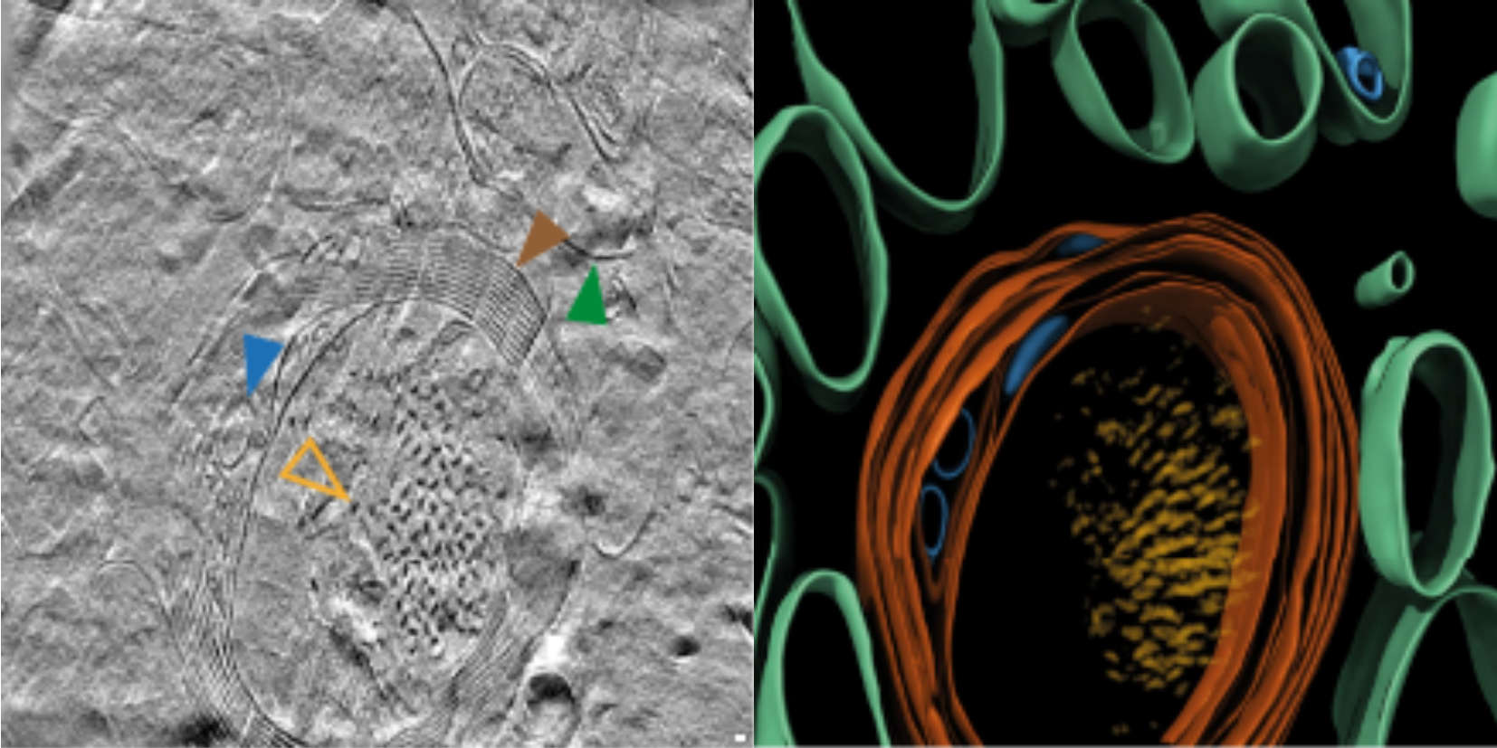阿尔茨海默病脑组织中Tau蛋白沉积的原位冷冻电子断层成像